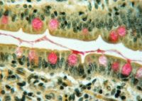 Mayer's Mucicarmine