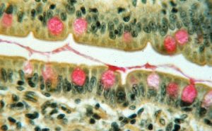 Mayer's Mucicarmine