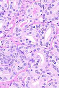 Prostate_HE_Great_Nuclear_Details_6